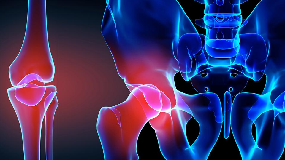 Facts about knee or hip joint replacements